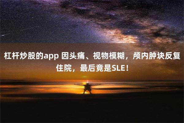 杠杆炒股的app 因头痛、视物模糊，颅内肿块反复住院，最后竟是SLE！